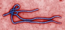 エボラウイルス感染を「確定」できない（写真：米CDC）