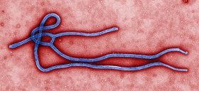エボラウイルス（写真：米疾病対策センター）