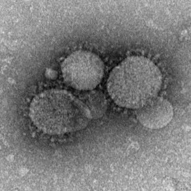 サウジアラビアでMERSコロナウイルスの感染が拡大している（米疾病予防管理センター撮影）