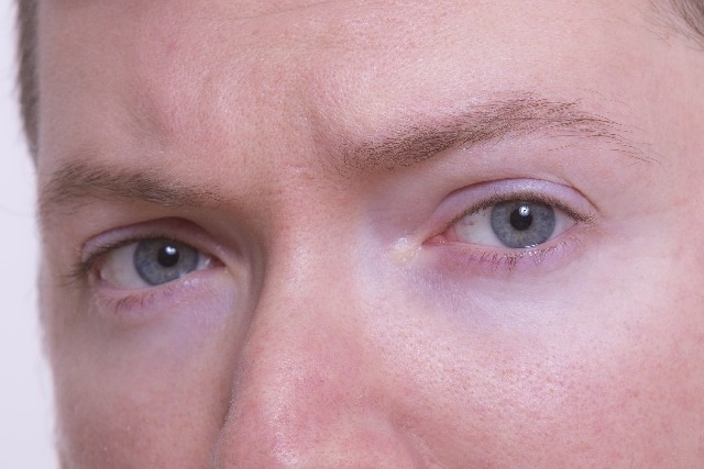 【男と女の相談室】50代の約半数は白内障　手術したら長生きする理由