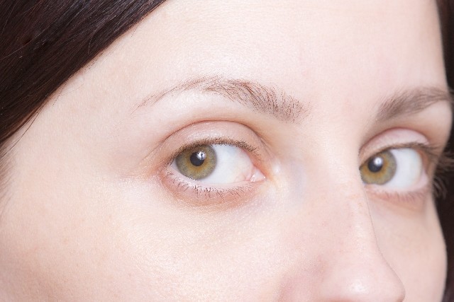 50歳の半分がかかる「白い恐怖」　白内障予防にはビタミンCを