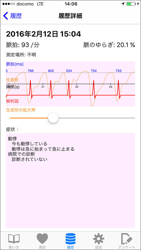 測定結果の画面。脈の揺らぎは波形とともに表示される