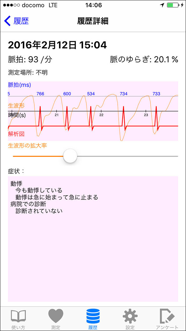 東大病院とドコモ「脈測定」iPhoneアプリ開発　データ収集して解析、不整脈発生予測に期待