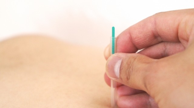 頑固な便秘に鍼（はり）治療が効く　西洋医学が中国の病院と協力し立証