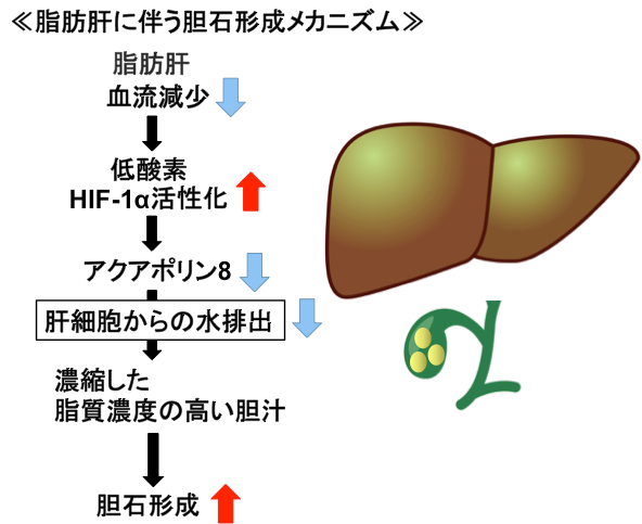 メタボだと胆石が増えやすい謎　マウス研究で「肝臓の酸素不足」だった