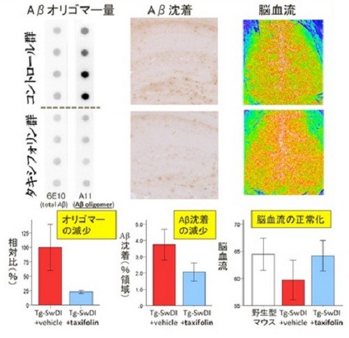 アルツハイマー病の新規治療薬開発へ　脳内の原因たんぱく質抑制物質判明