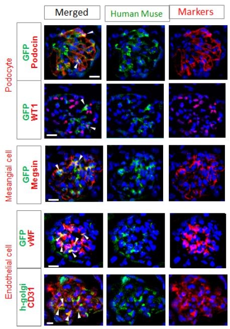 iPS細胞に続け！Muse細胞　「治療法なし」慢性腎臓病に効果期待
