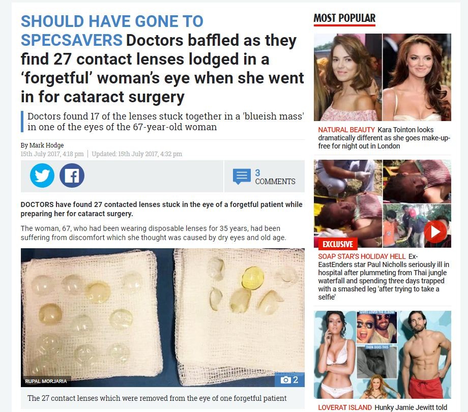 67歳女性の目からコンタクト17個　それだけ入れて気がつかない？