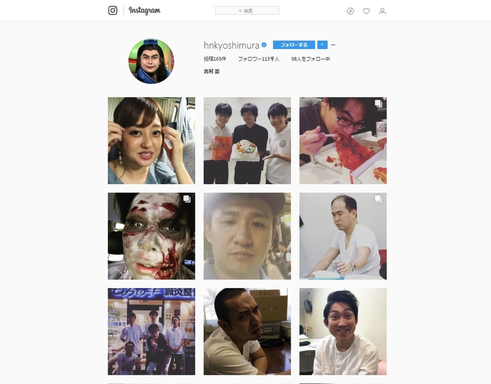 菊地亜美の「ぶっさいく」写真公開　ノブコブ吉村「なんで彼氏ができたんだろう...」