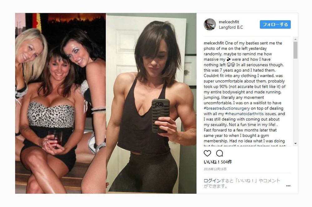 巨乳は果たして小さくできるのか？　米トレーナー、7年かけてバストを縮める