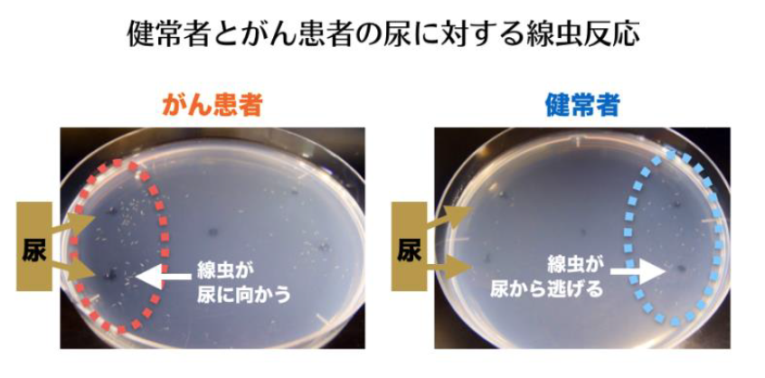 1ミリの線虫が尿の匂いでがん診断　前立腺がんの早期発見の研究開始