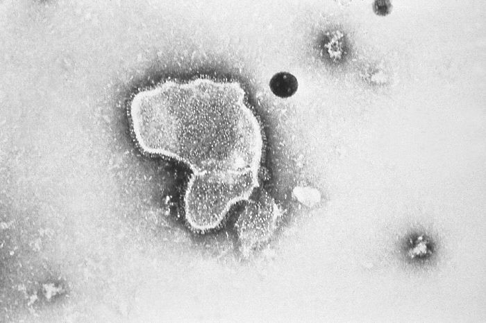 RSウイルス大流行、赤ちゃん要注意　夏でも感染拡大もはや危険水域