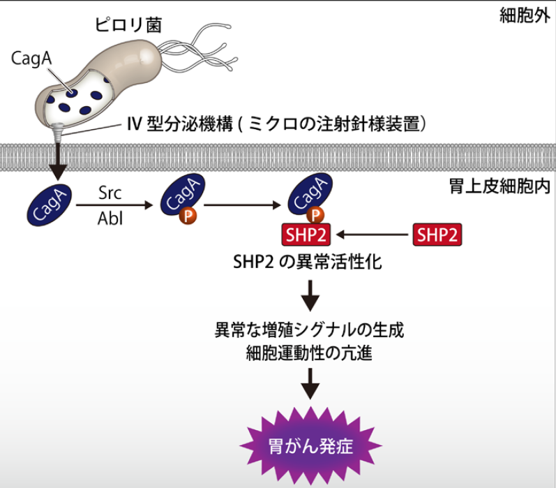 日本のピロリ菌は最悪と判明 　胃がんの発症が欧米型より100倍危険