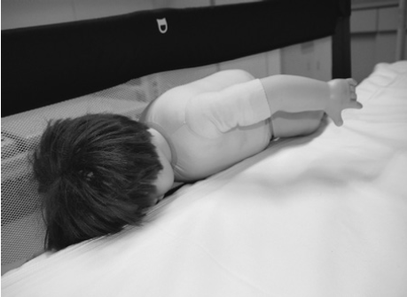 男児がベッドガードはさまった状態を人形で再現（日本小児科学会の傷害速報より）
