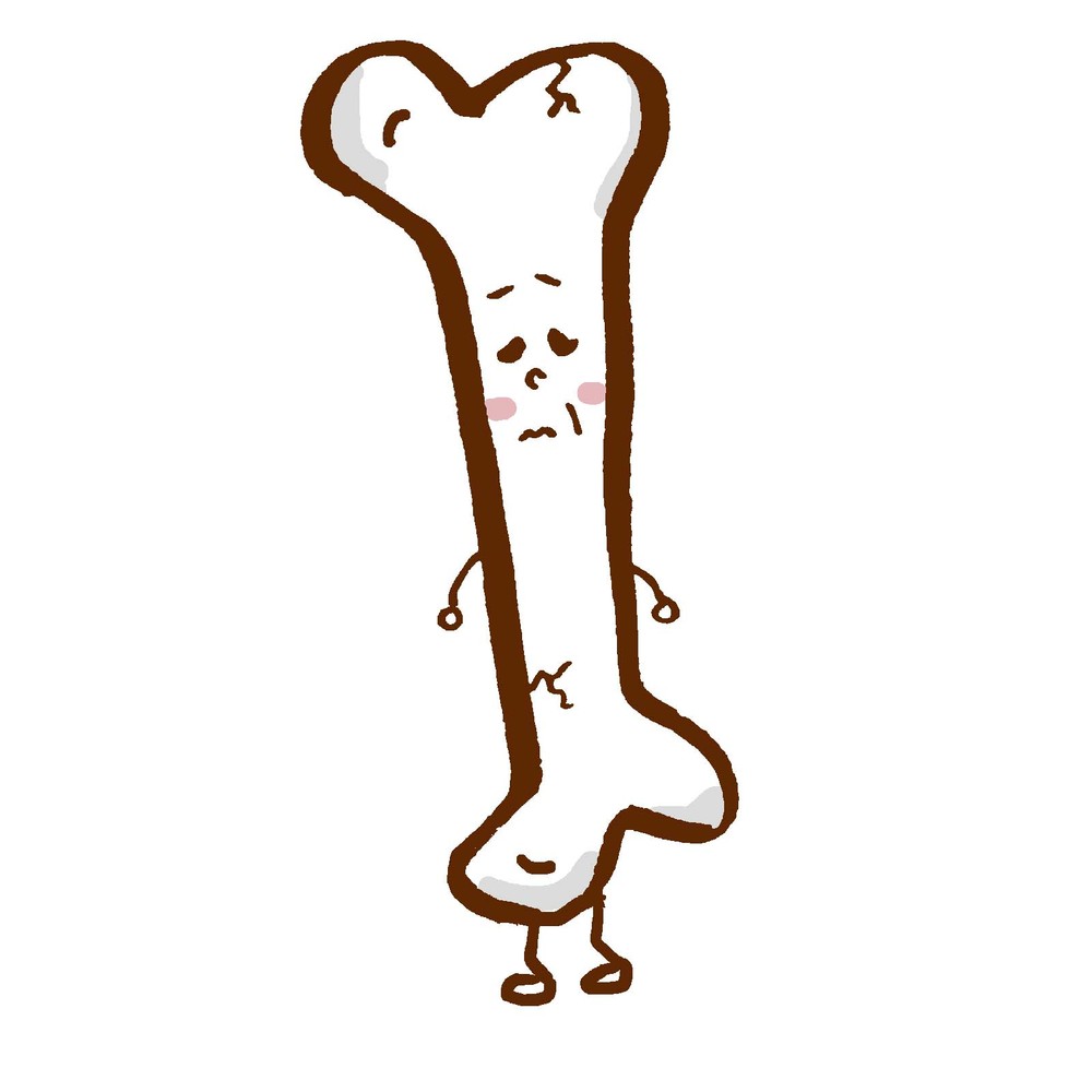 骨粗しょう症連携手帳、サンプル版ができた<br/>　 初版 5万部、普及めざす