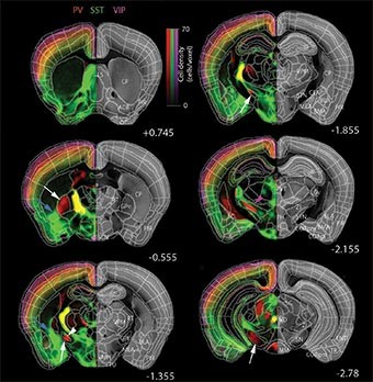 最新テクが発見！　女脳は男脳よりスゴイ　大きさでは男脳だが脳神経の数は女が上！