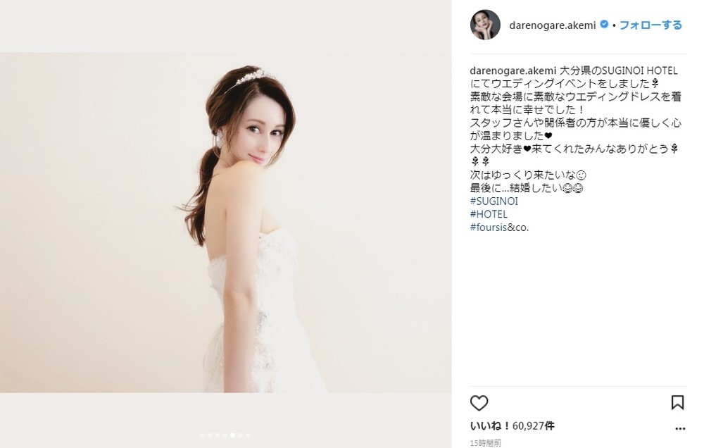 カメラ目線のダレノガレさん（画像はダレノガレ明美さんのインスタグラムより）