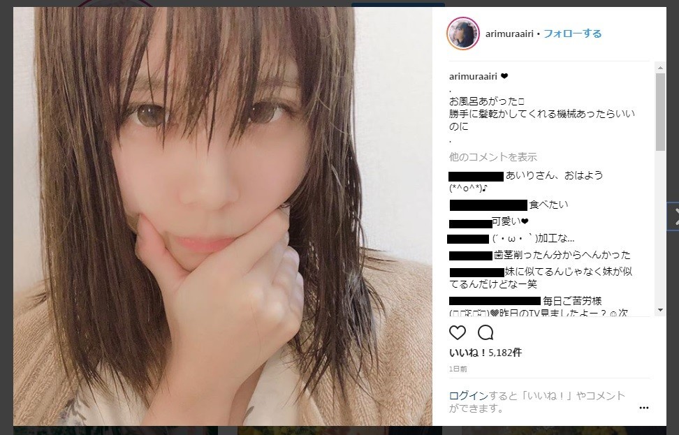 有村藍里、口元コンプレックスから歯茎矯正　かわいくなったのか