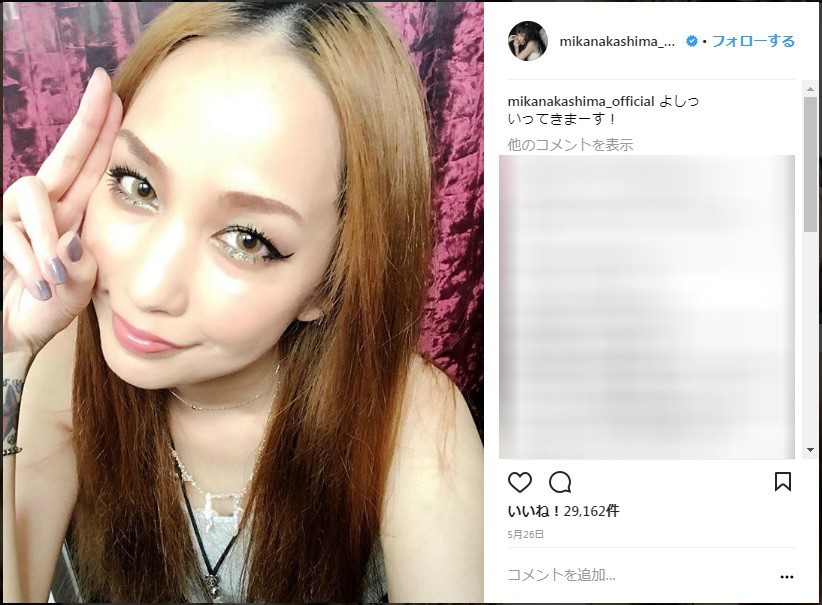 中島美嘉、顔変わった？　本人「コンプレックスの塊の私は...」