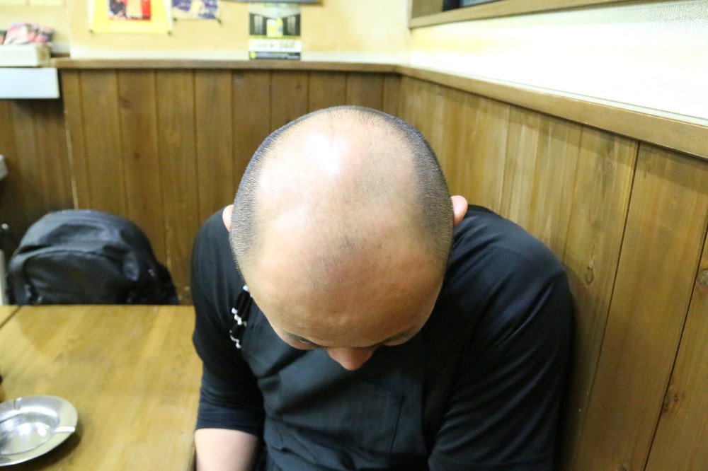 昔よりも髪の毛が減った？現在の進行具合を披露した小口さん