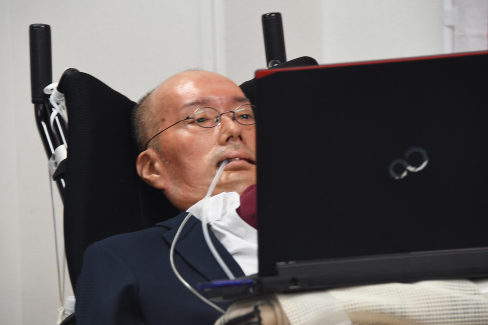 れいわ舩後氏も使う「意思伝達装置『伝の心』」　開発背景には「従業員のALS罹患」があった