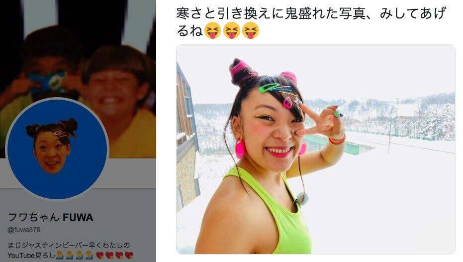 フワちゃん、交通事故被害もケロリ 両足傷だらけ→翌朝に生放送出演