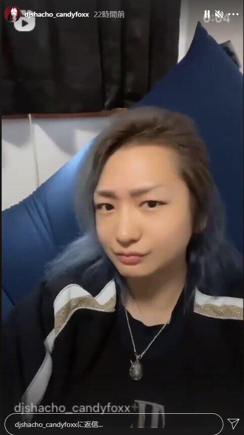 整形後のDJ社長（インスタグラムより）