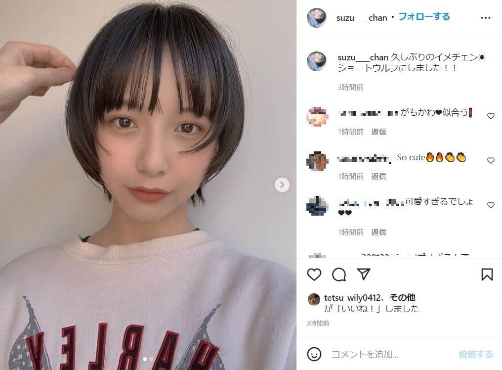 山之内すず「頭蓋骨まで叩かれてる」　レントゲン写真への批判に「辛辣すぎてつらい」
