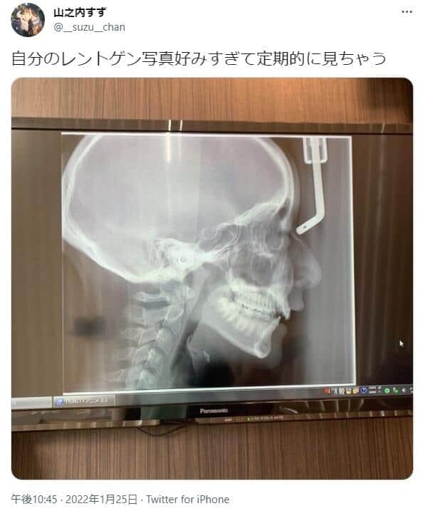 山之内すずさんのツイッターから