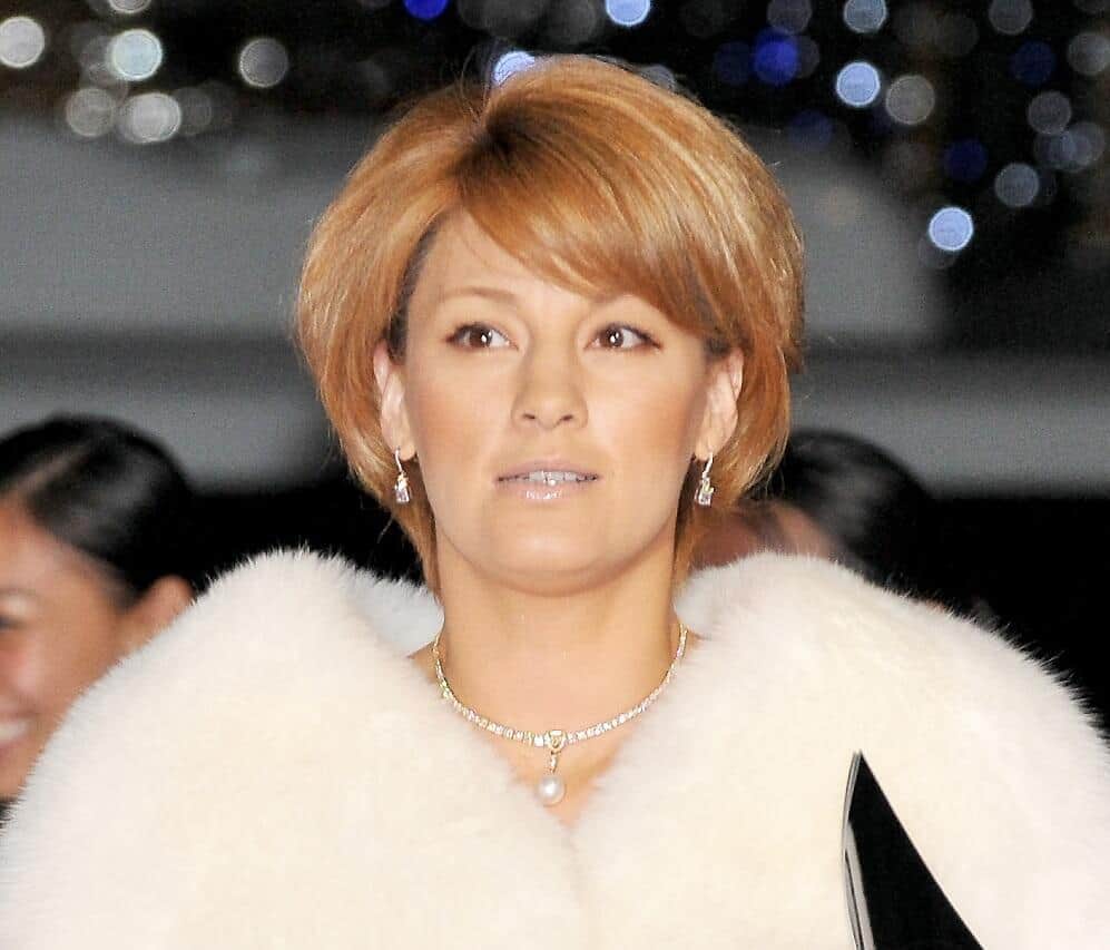 梅宮アンナ、顔の皮膚炎の経過報告　真っ赤にかぶれた状態からは回復も...「まだ体内に毒がある」