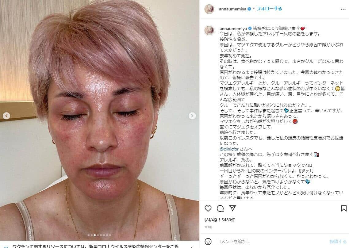 梅宮さんのインスタグラム（＠annaumemiya）より