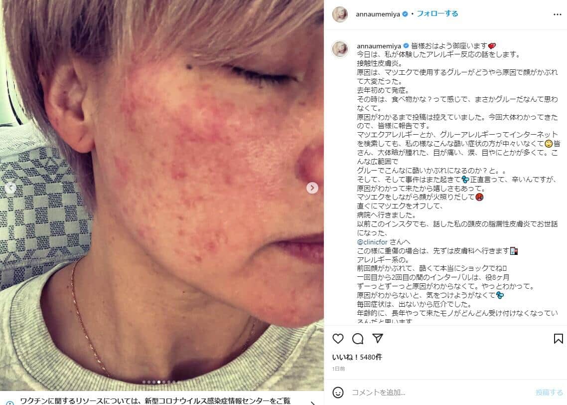 梅宮さんのインスタグラム（＠annaumemiya）より