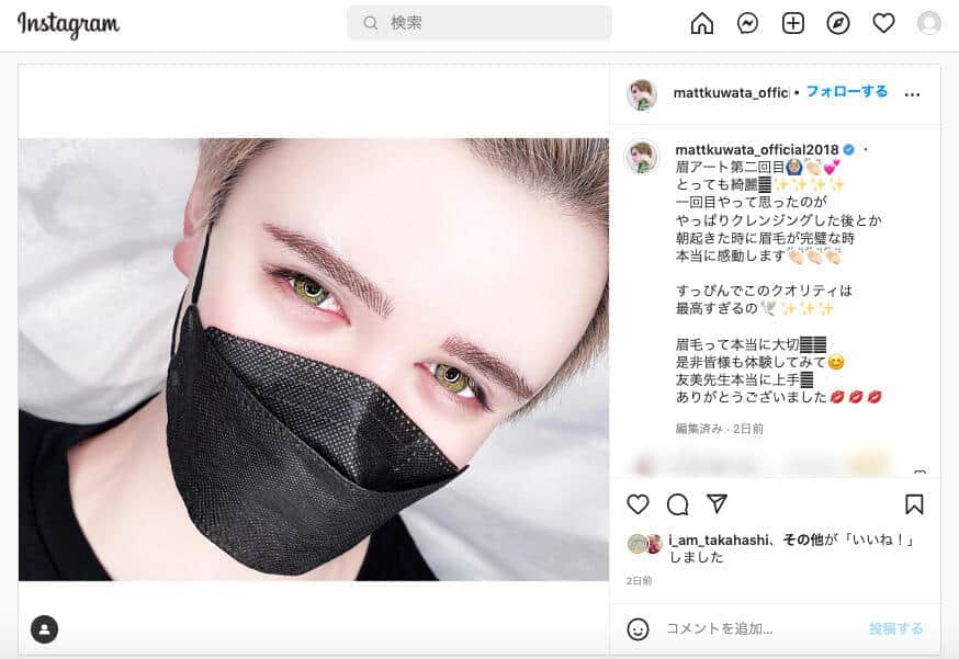 Matt、唇にヒアルロン酸注入で自画自賛　「アンジーみたい」