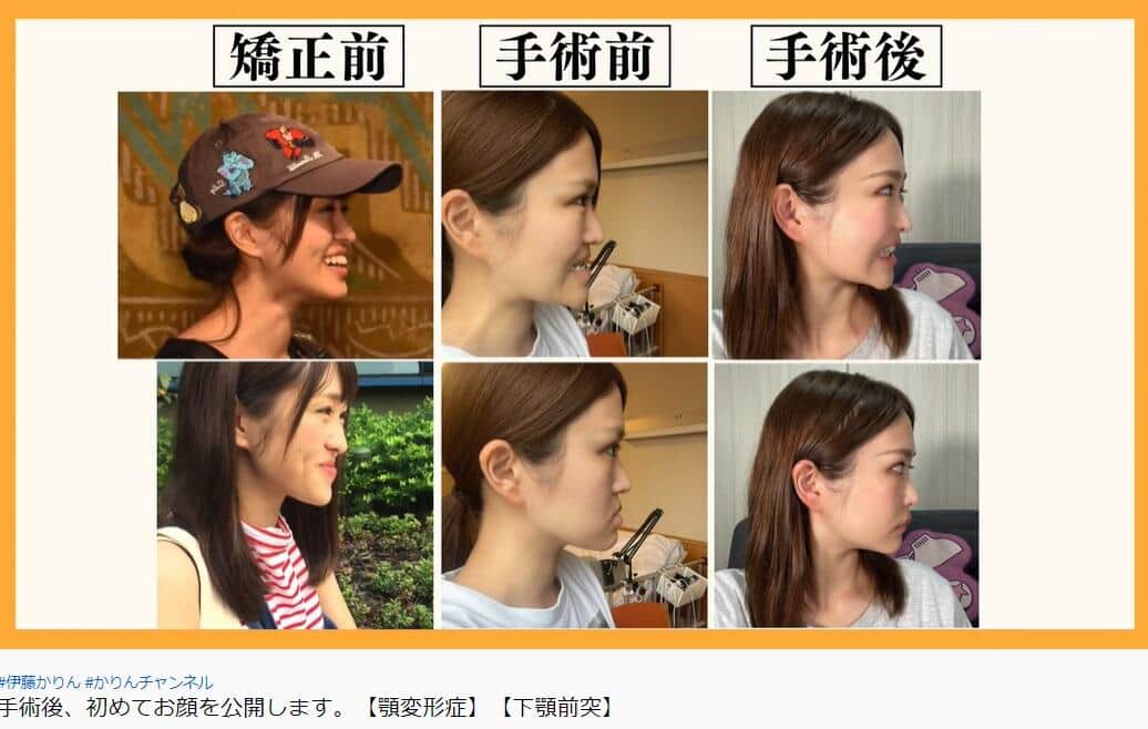 伊藤かりんさんのYouTube動画より