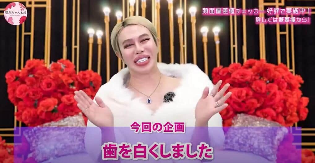 「大工事」を終えたアレンさんの歯（アレンさんの22年6月28日の動画より）