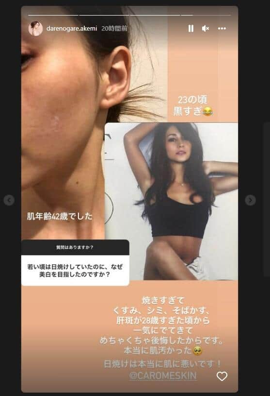 ダレノガレさんのインスタグラム（＠darenogare.akemi）より