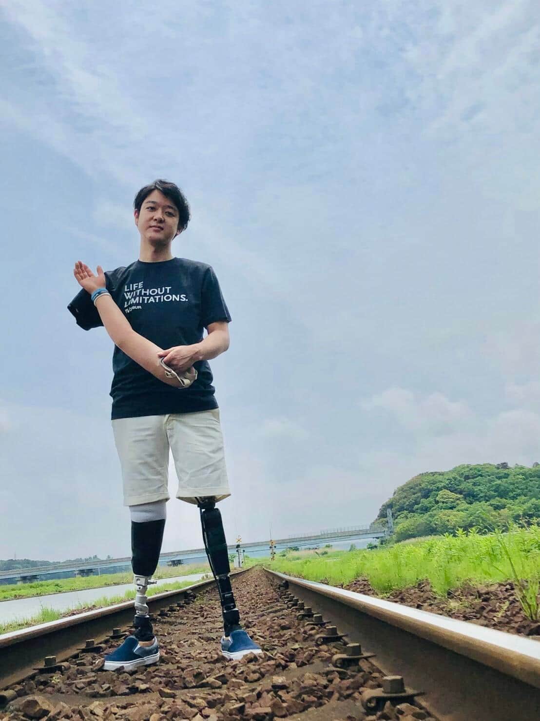 手足3本失い10年「僕は今、人生を楽しんでいる」　「奇跡で助かった男」は今日も誰かのために発信を続ける