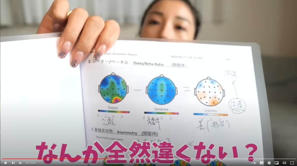 YouTubeチャンネル「木下優樹菜ですっ」の動画より。資料中央にある脳のデータが「普通の34歳女性」のもので、同左が木下さんのものだという