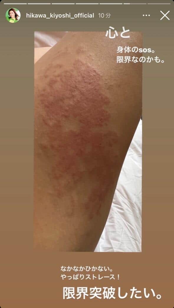 氷川きよしさんのインスタグラム（hikawa_kiyoshi_official）より