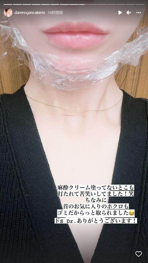 ダレノガレ明美さんのインスタグラム（darenogare.akemi）より