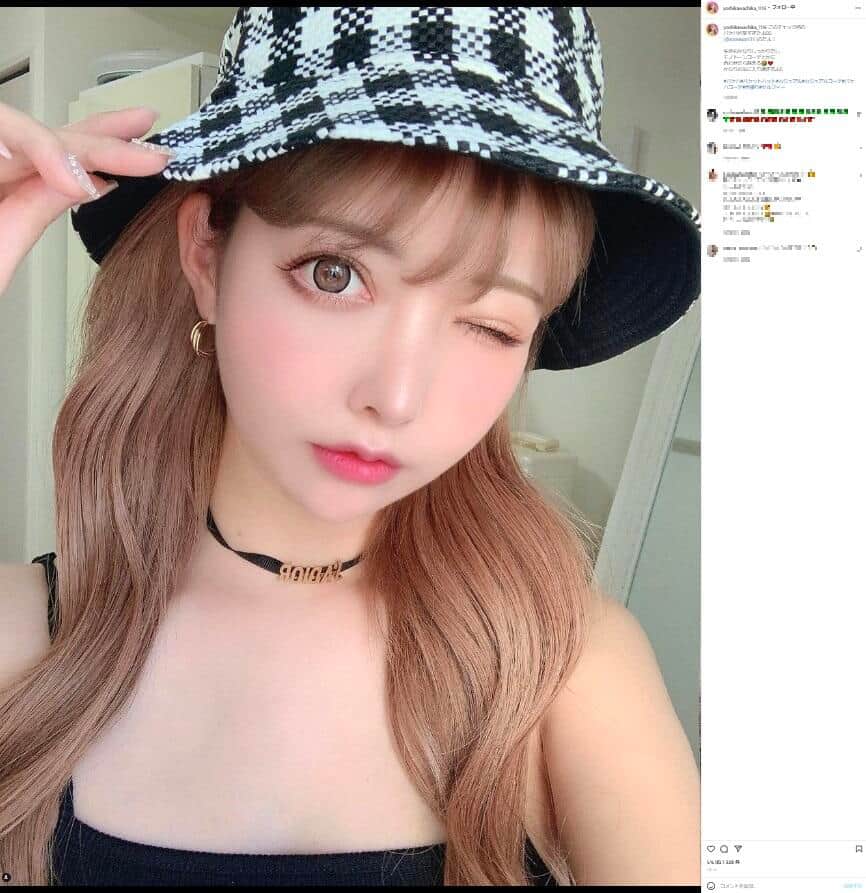 整形総額2000万モデル「グロ注意です」　施術で顔全体が真っ赤に...「パワーは強め」