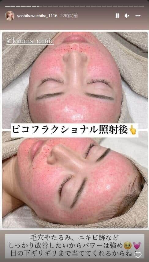 吉川ちかさんのインスタグラム（yoshikawachika_1116）より