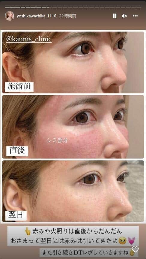 吉川ちかさんのインスタグラム（yoshikawachika_1116）より