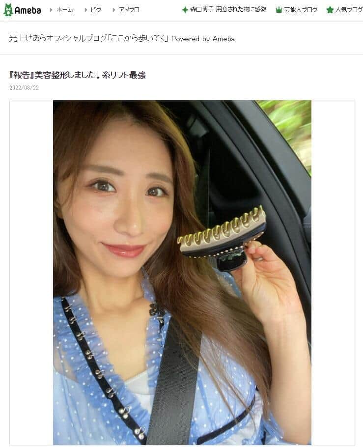 元SDN光上せあら、整形告白　ビフォーアフター見比べ大満足「顔の余白の長さが全然違う！」