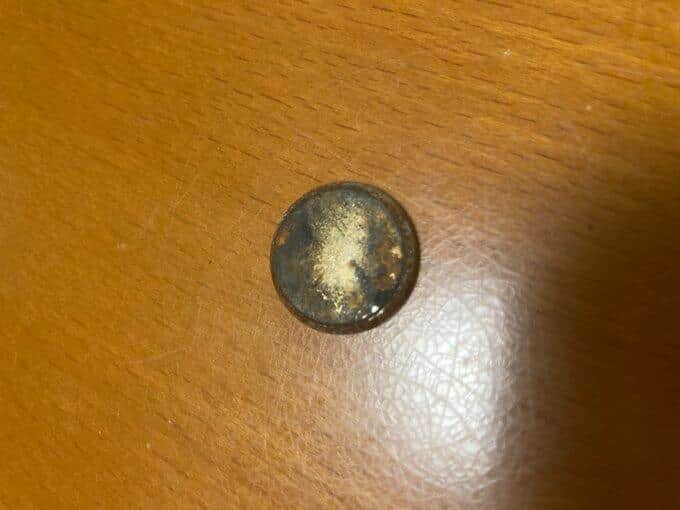 「数分目を離した隙に...」2歳息子がボタン電池誤飲　即搬送も緊急入院、リスク伝えた母親体験談に注目