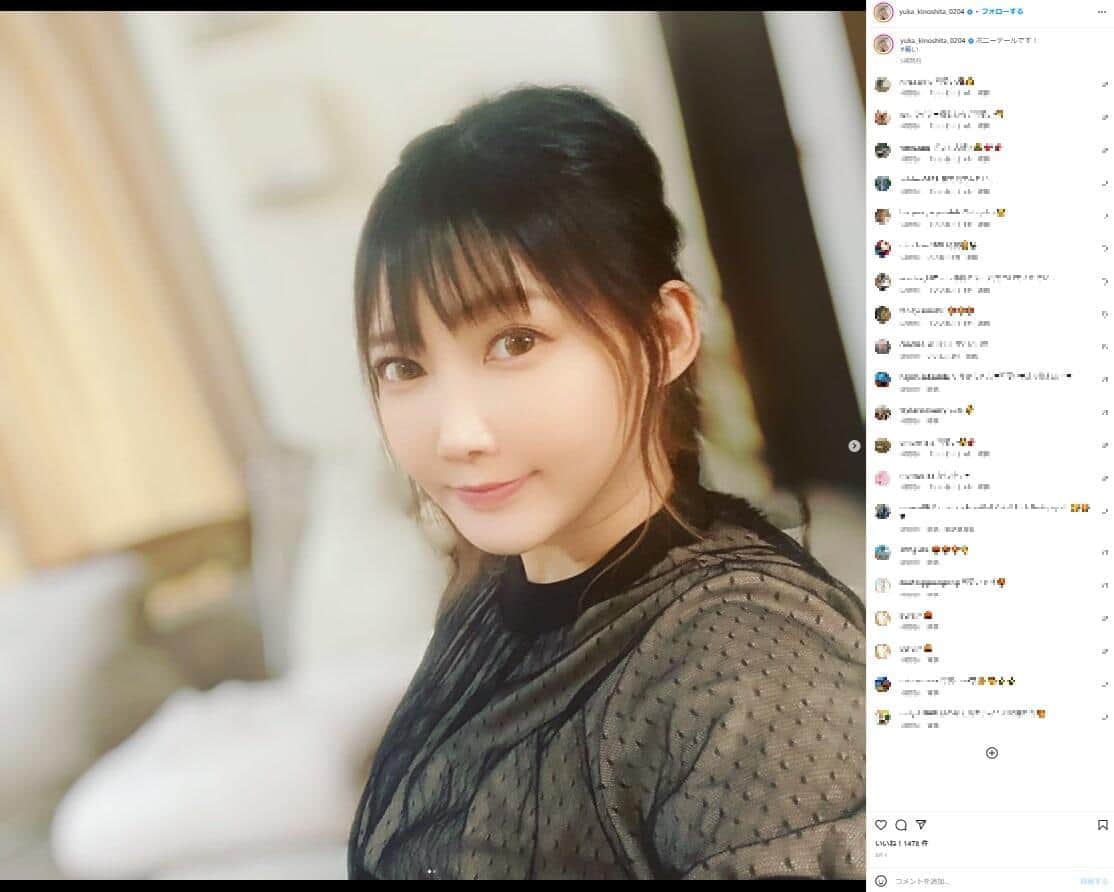 人気YouTuber「リアルはさらにブス」　脂肪吸引ダウンタイムの顔を自虐「めっちゃおたふくさん」