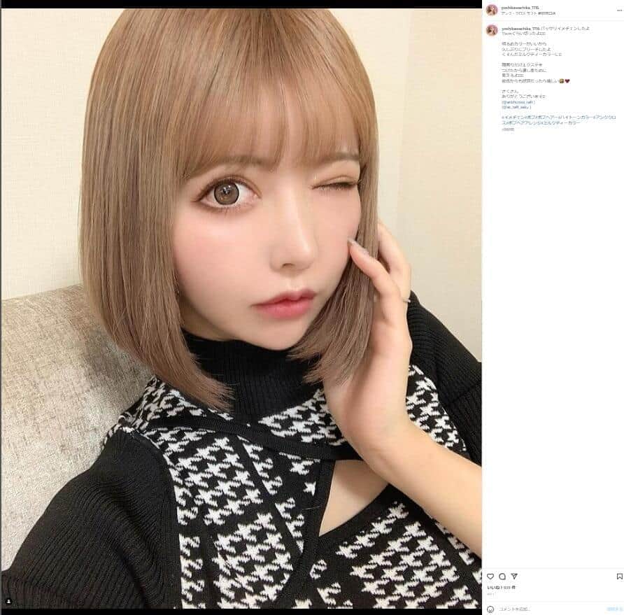 「かなり顔が小さくなりました」　整形総額2000万モデル、「輪郭削り」で劇的変化...ビフォーアフター公開