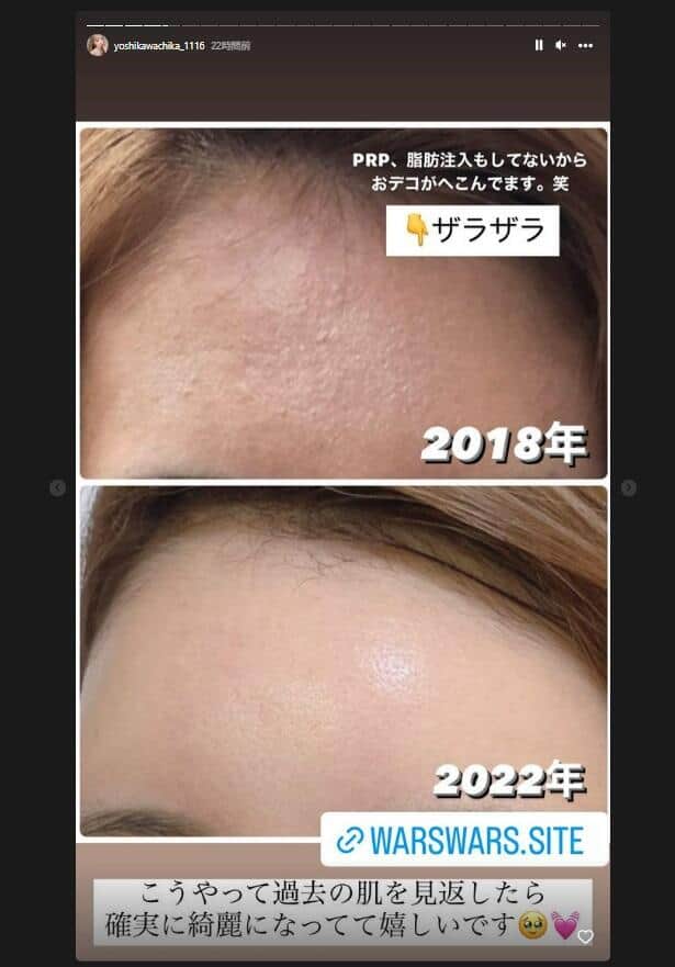 吉川ちかさんのインスタグラム（yoshikawachika_1116）より