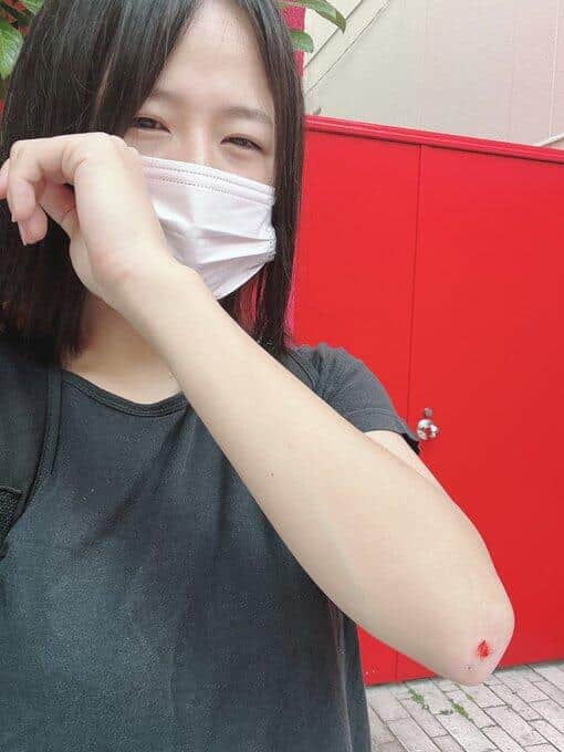 ケガを負ったまおさん（ツイッター投稿から）