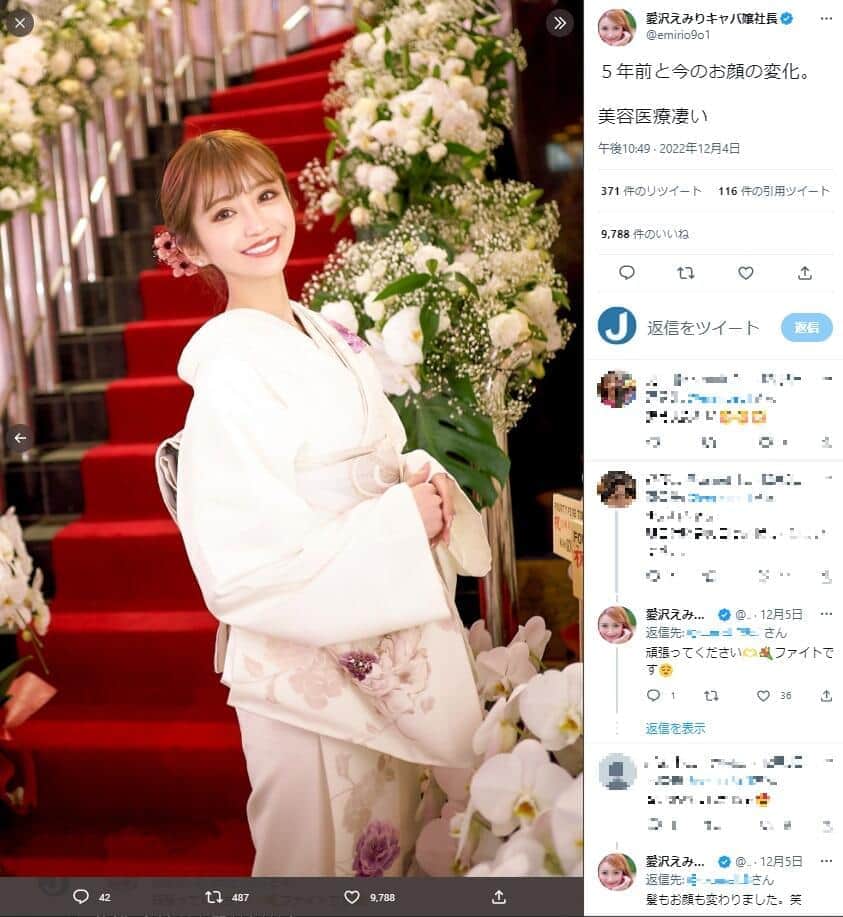 整形1000万・元キャバ嬢モデルに「若返ってます」「違う人みたい」　5年前からの変化に衝撃